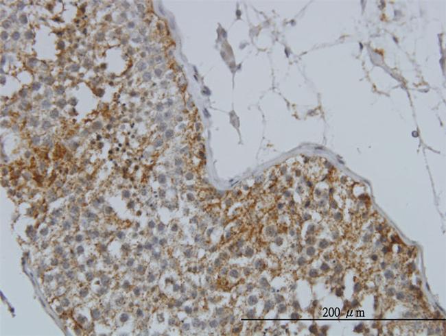 GYG1 Antibody in Immunohistochemistry (Paraffin) (IHC (P))