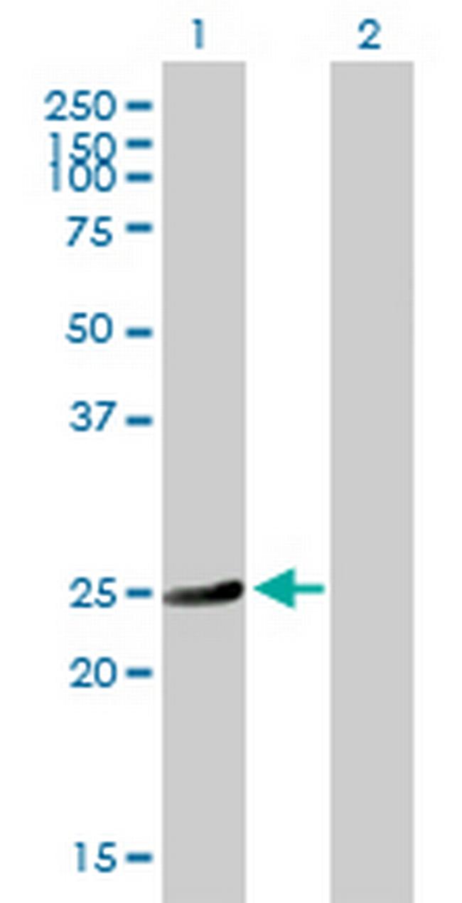 HSD17B10 Antibody in Western Blot (WB)