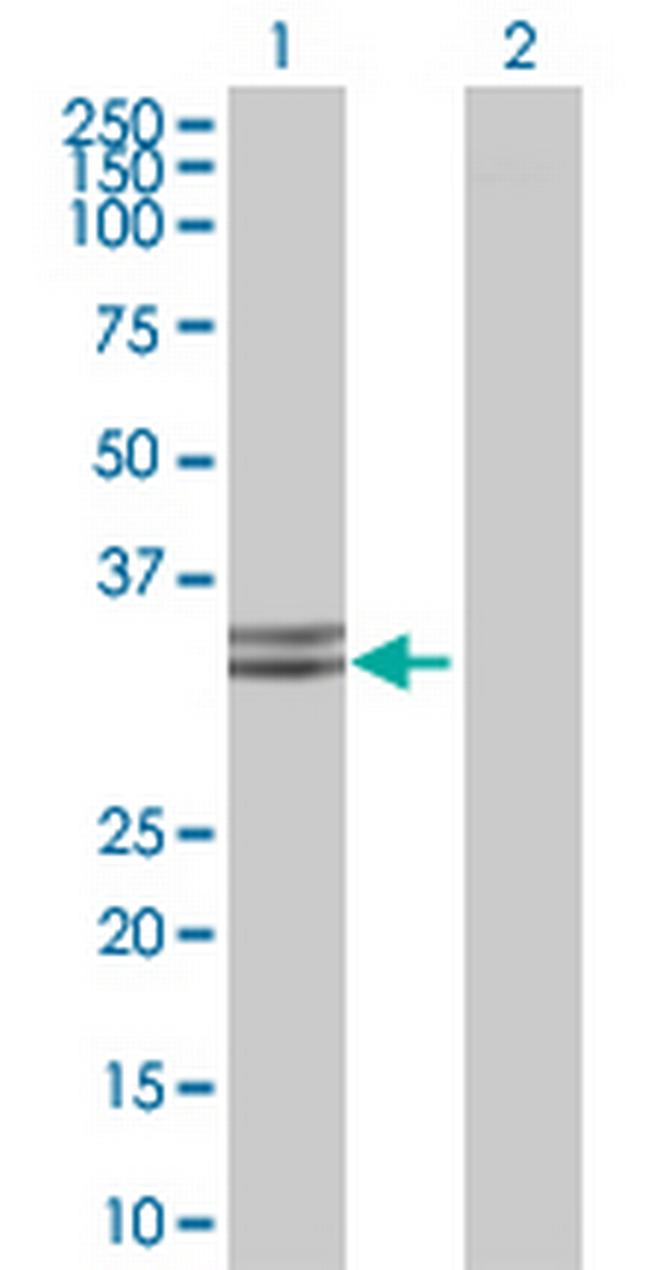 HADHSC Antibody in Western Blot (WB)