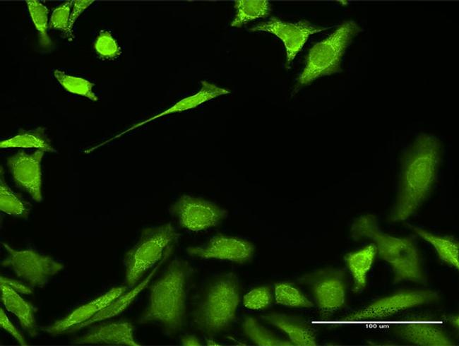 HADH Antibody in Immunocytochemistry (ICC/IF)