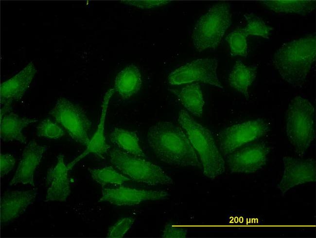 HADHSC Antibody in Immunocytochemistry (ICC/IF)