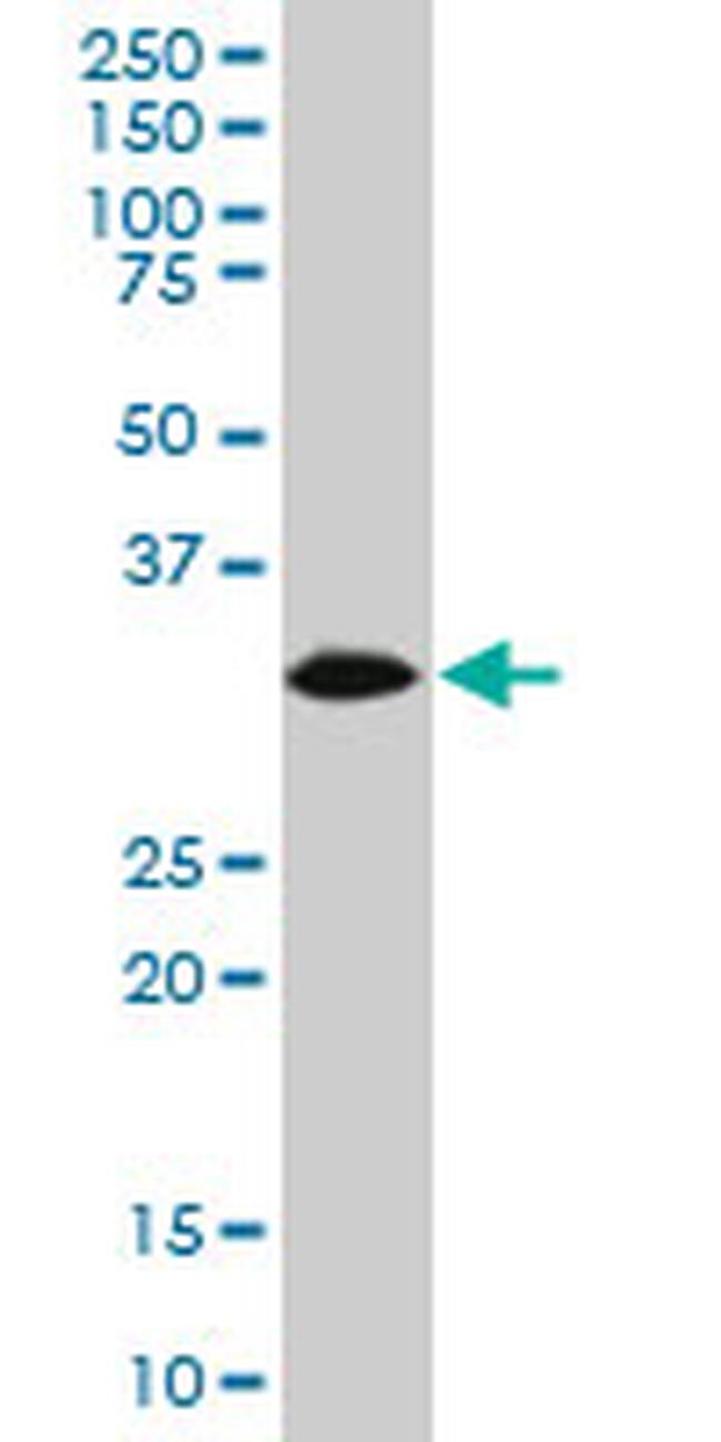 HADHSC Antibody in Western Blot (WB)