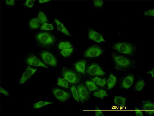 HARS Antibody in Immunocytochemistry (ICC/IF)