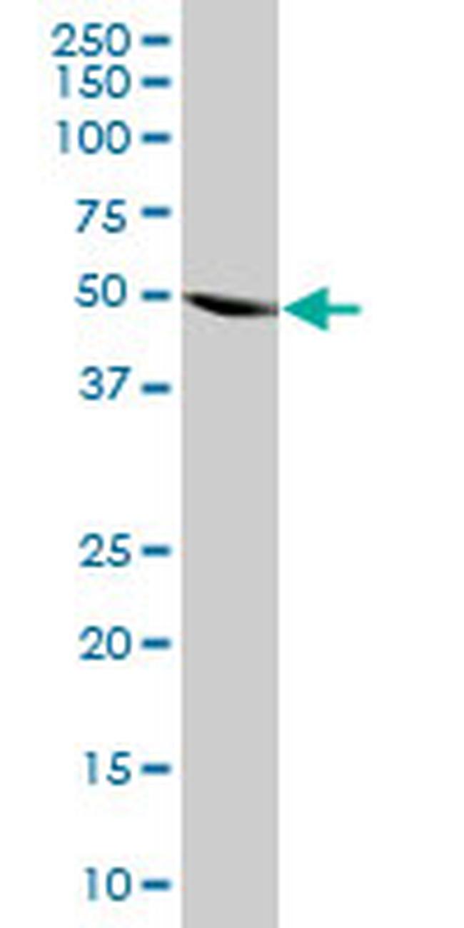 HARS Antibody in Western Blot (WB)