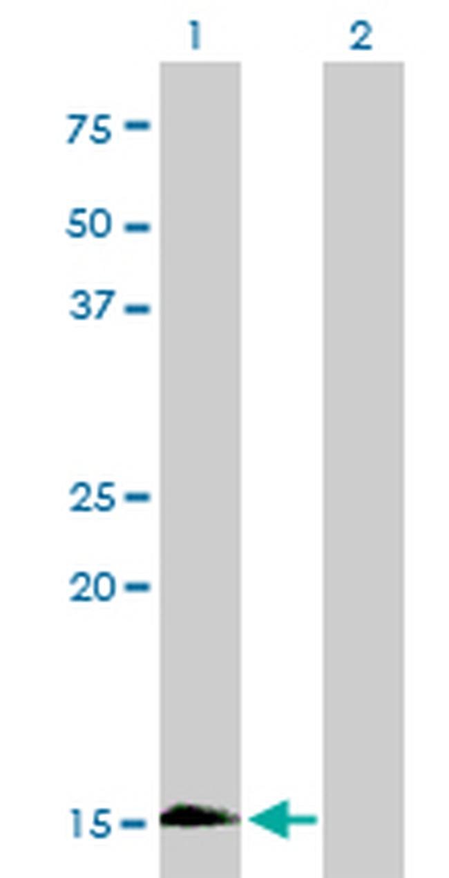 HBZ Antibody in Western Blot (WB)