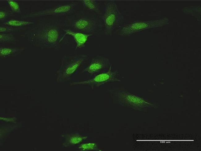 HCK Antibody in Immunocytochemistry (ICC/IF)