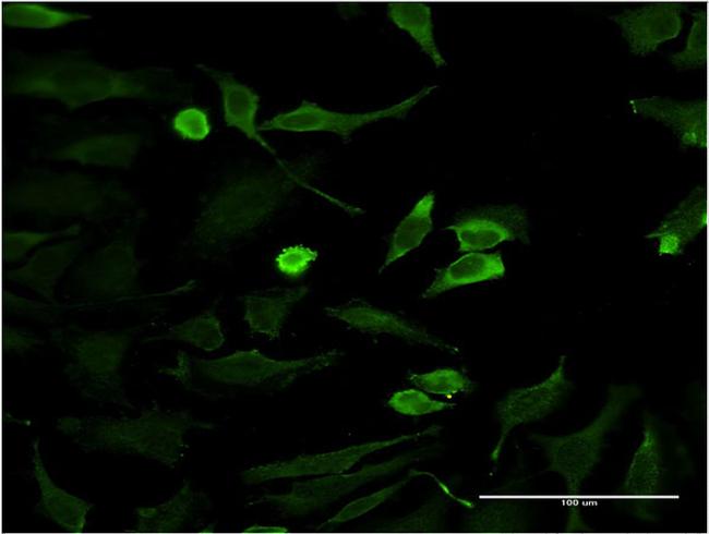 HD Antibody in Immunocytochemistry (ICC/IF)