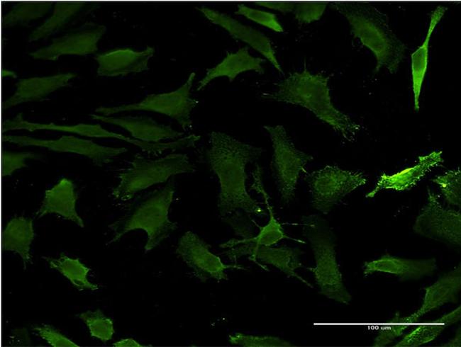 HD Antibody in Immunocytochemistry (ICC/IF)