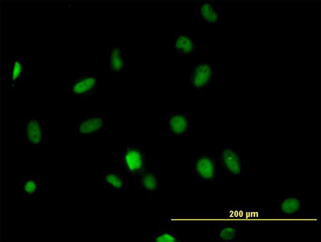 HDAC1 Antibody in Immunocytochemistry (ICC/IF)