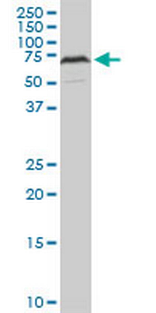 HDAC1 Antibody in Western Blot (WB)