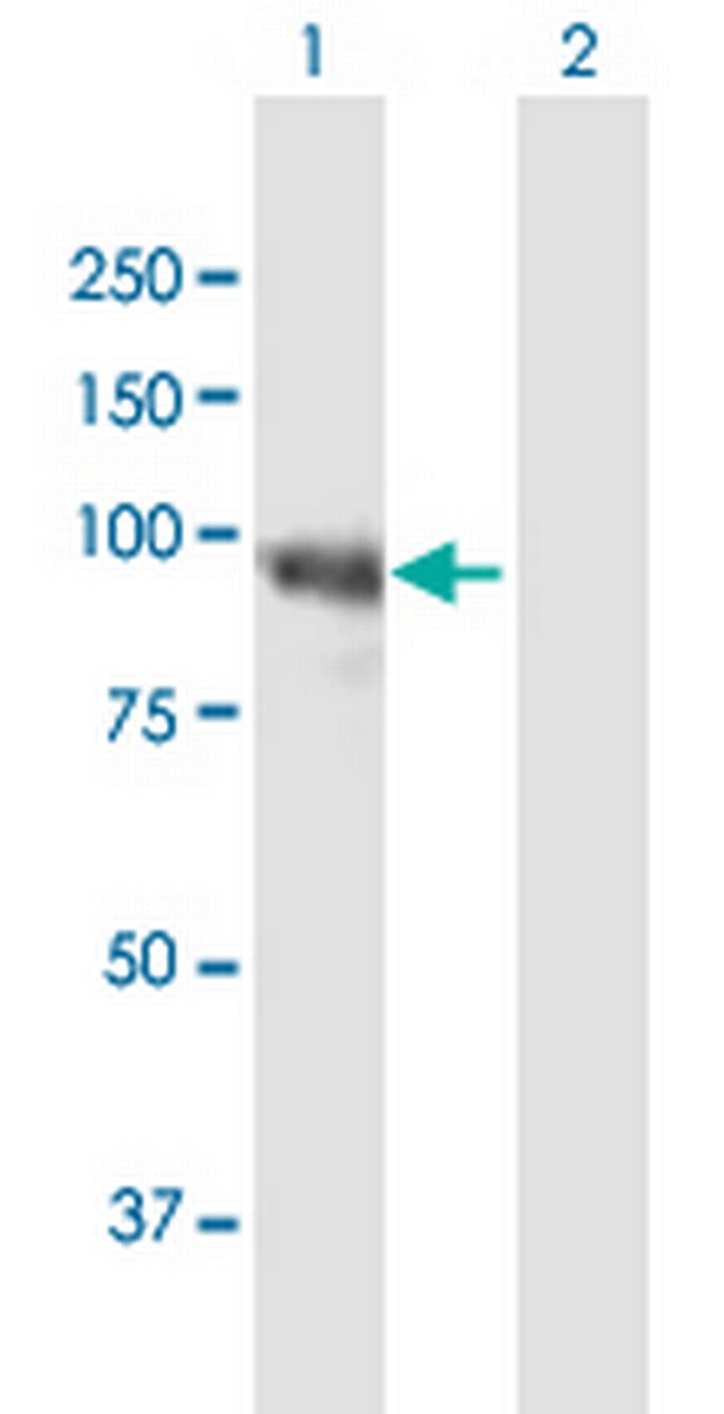 HELLS Antibody in Western Blot (WB)