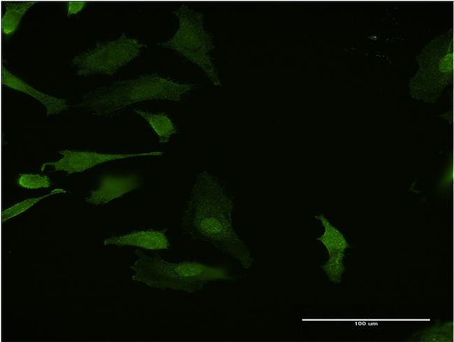 HHEX Antibody in Immunocytochemistry (ICC/IF)