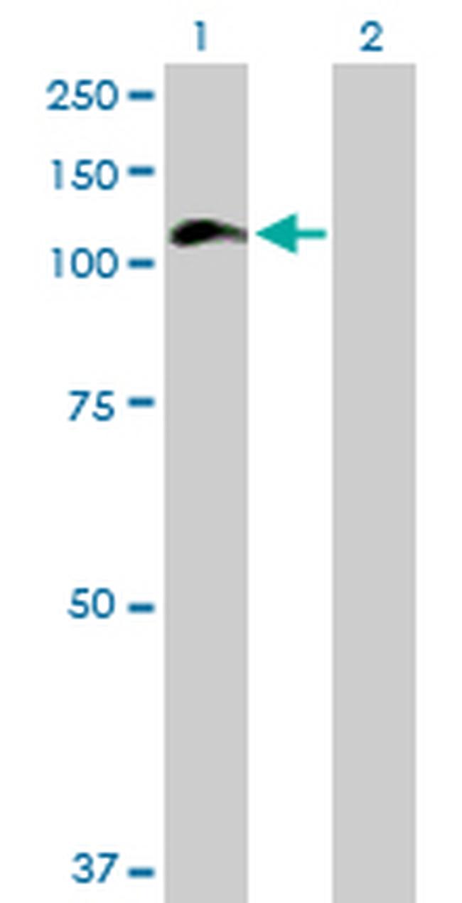 HIP1 Antibody in Western Blot (WB)