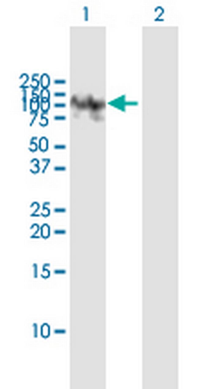 HK2 Antibody in Western Blot (WB)