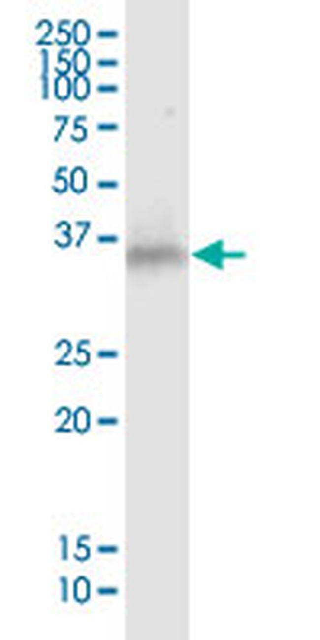 HLA-G Antibody in Western Blot (WB)