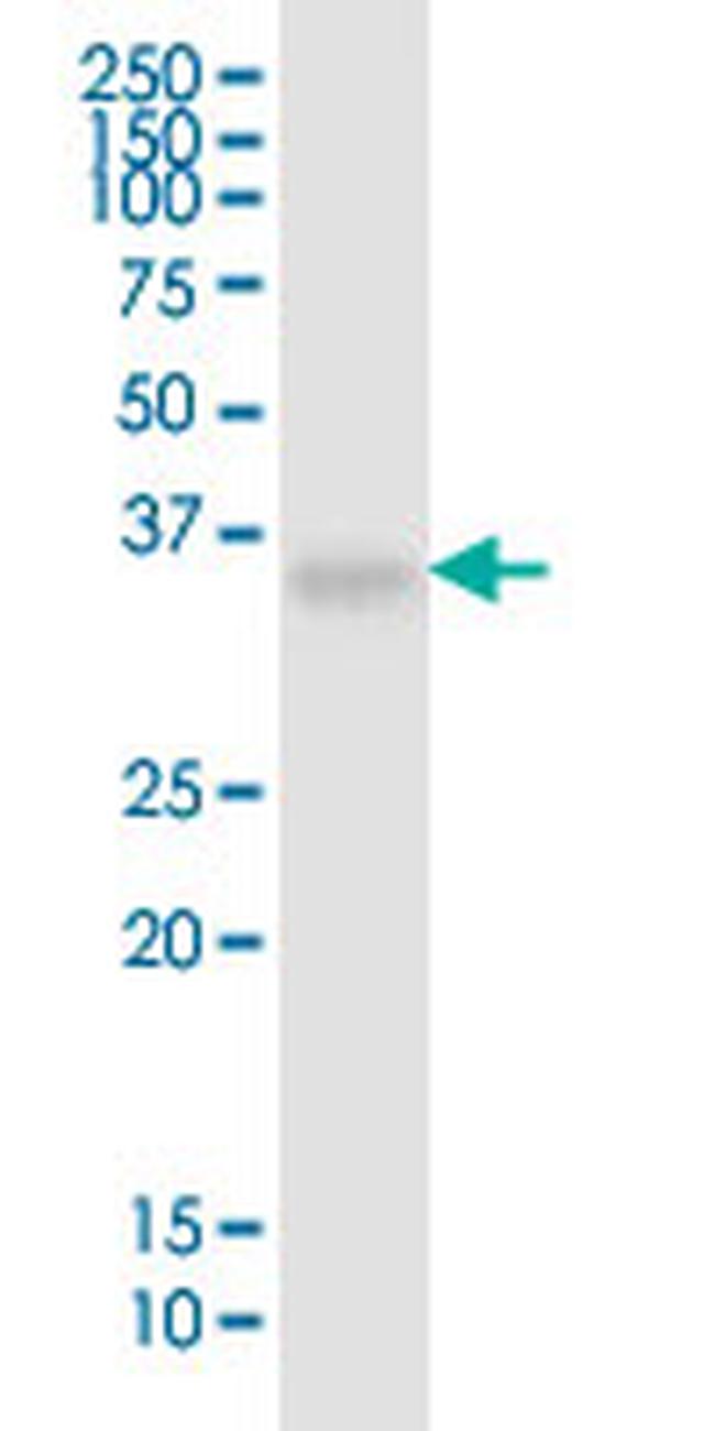 HLA-G Antibody in Western Blot (WB)