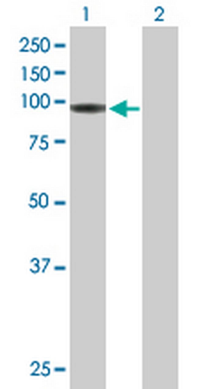 HLCS Antibody in Western Blot (WB)