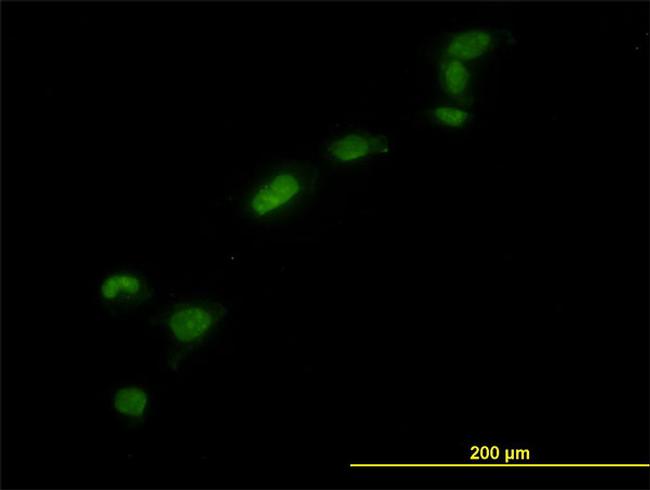 HMGB1 Antibody in Immunocytochemistry (ICC/IF)