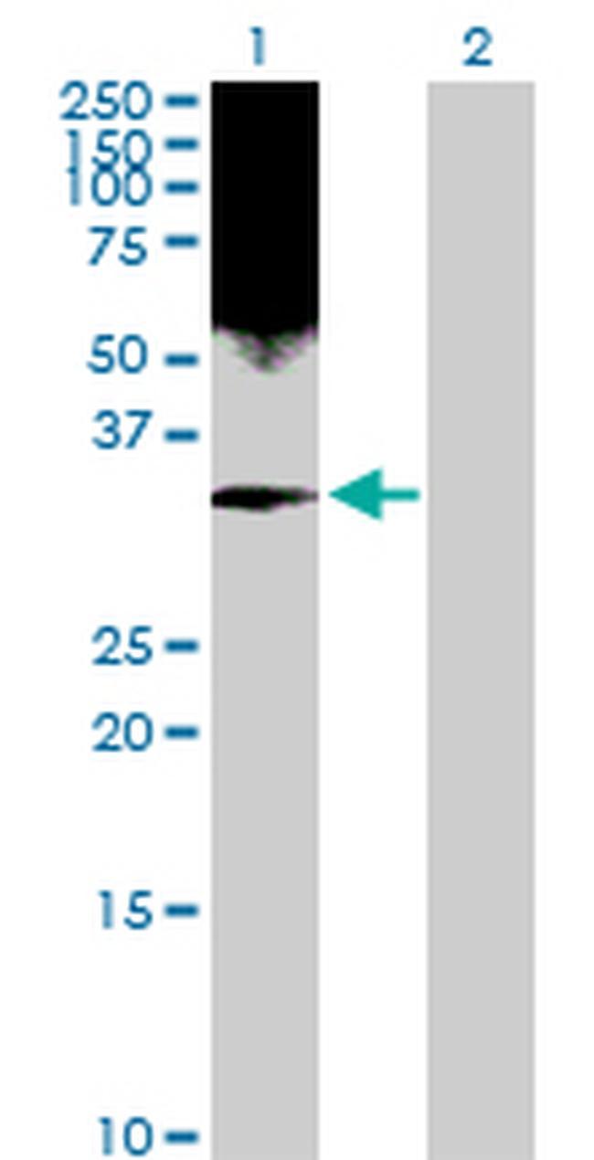 HMGB2 Antibody in Western Blot (WB)