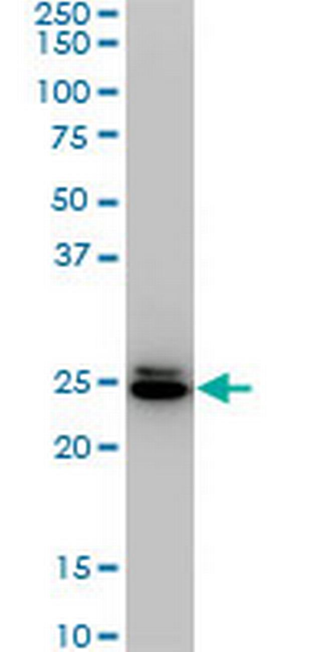 HMGB2 Antibody in Western Blot (WB)