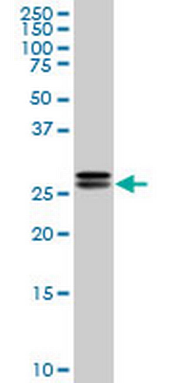 HMGB2 Antibody in Western Blot (WB)