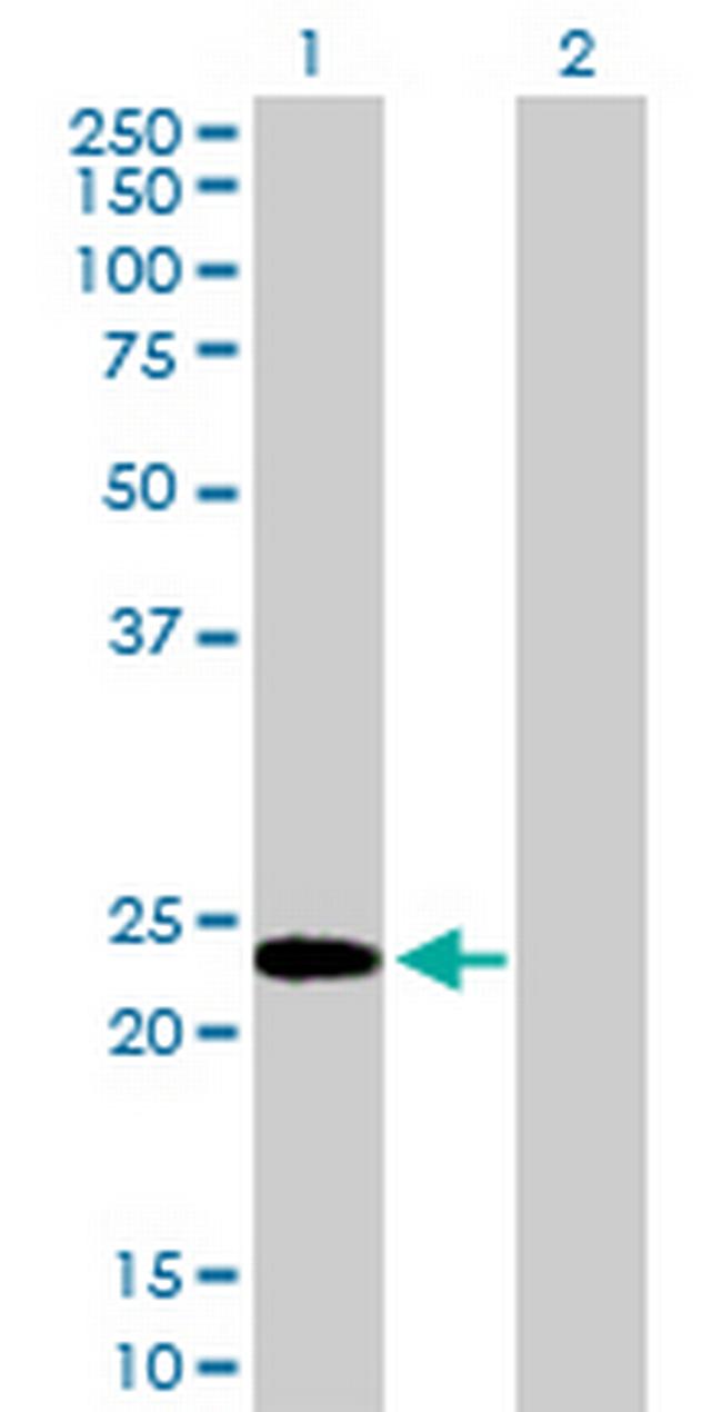 HMGB3 Antibody in Western Blot (WB)