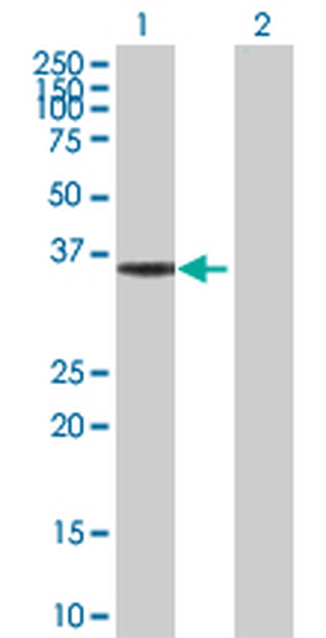 HMGCL Antibody in Western Blot (WB)