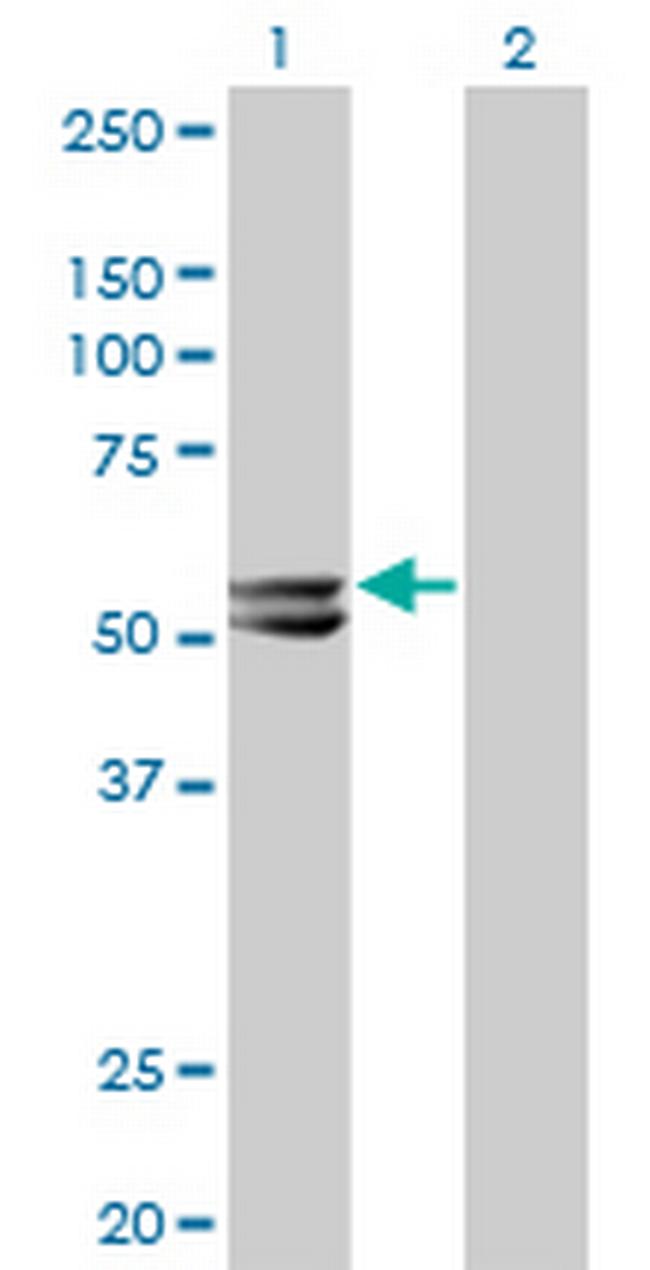 HMGCS2 Antibody in Western Blot (WB)