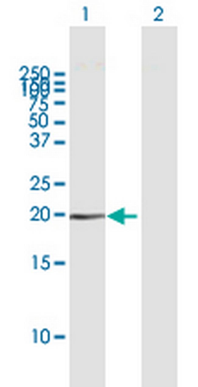 HMGA1 Antibody in Western Blot (WB)