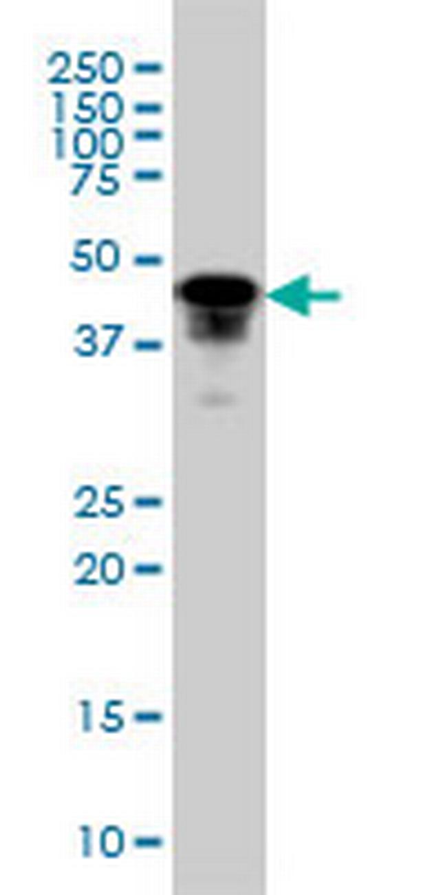 FOXA1 Antibody in Western Blot (WB)