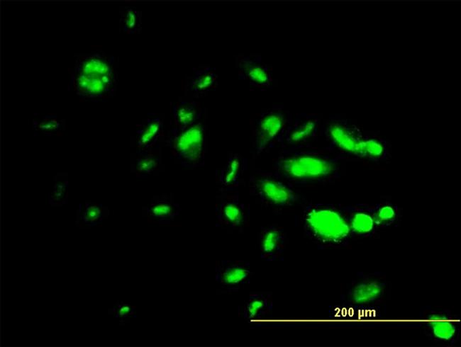 FOXA1 Antibody in Immunocytochemistry (ICC/IF)