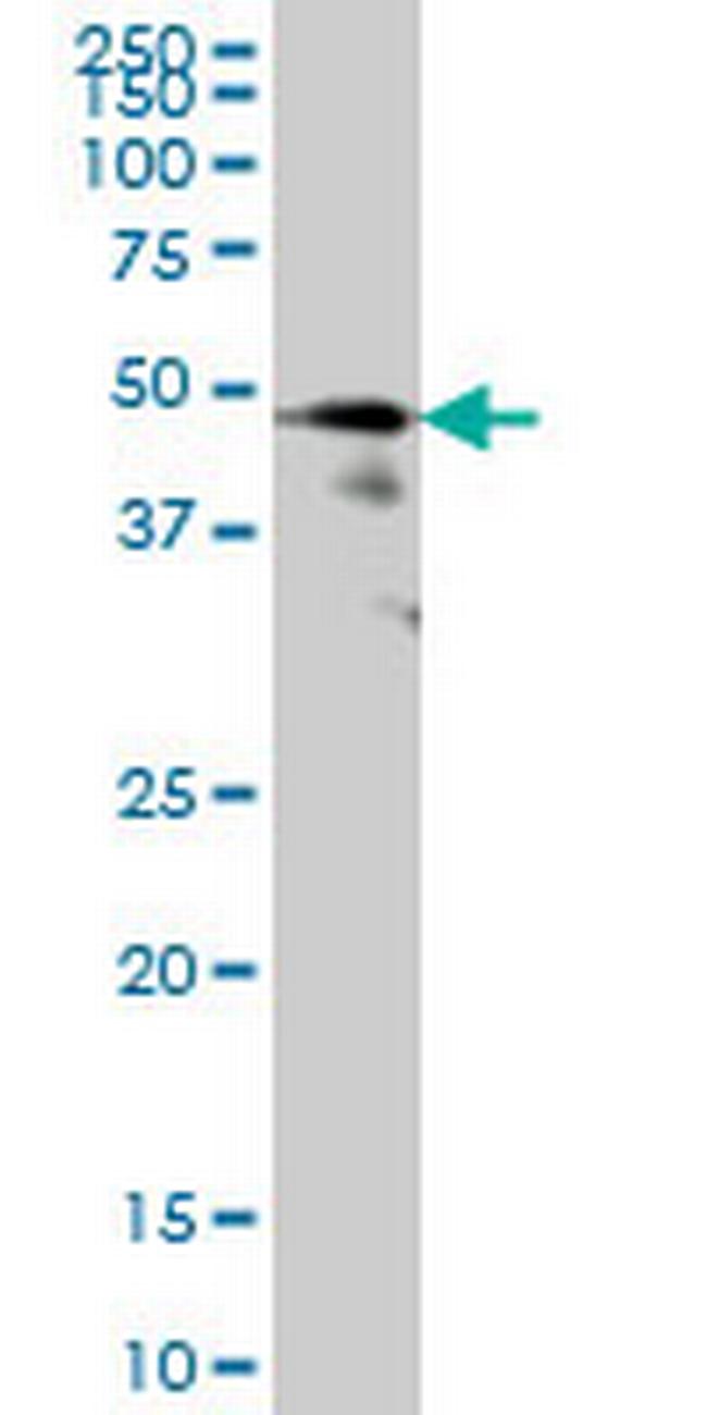 FOXA1 Antibody in Western Blot (WB)