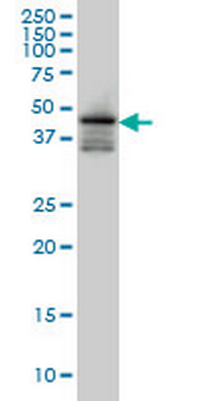 FOXA2 Antibody in Western Blot (WB)