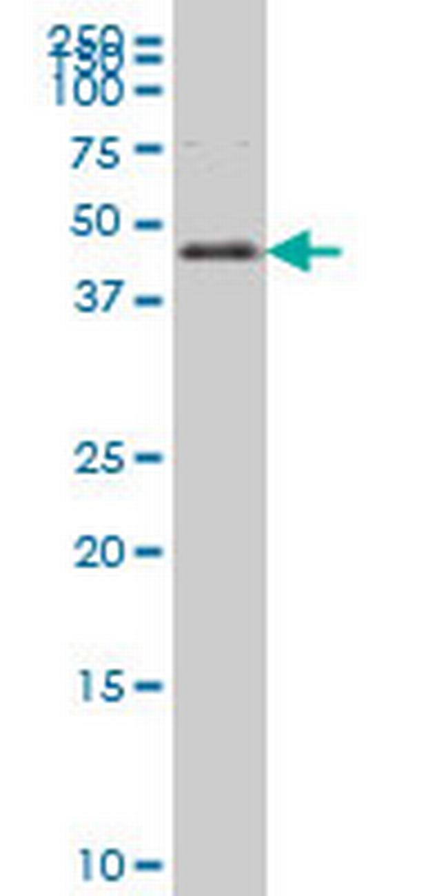 FOXA2 Antibody in Western Blot (WB)