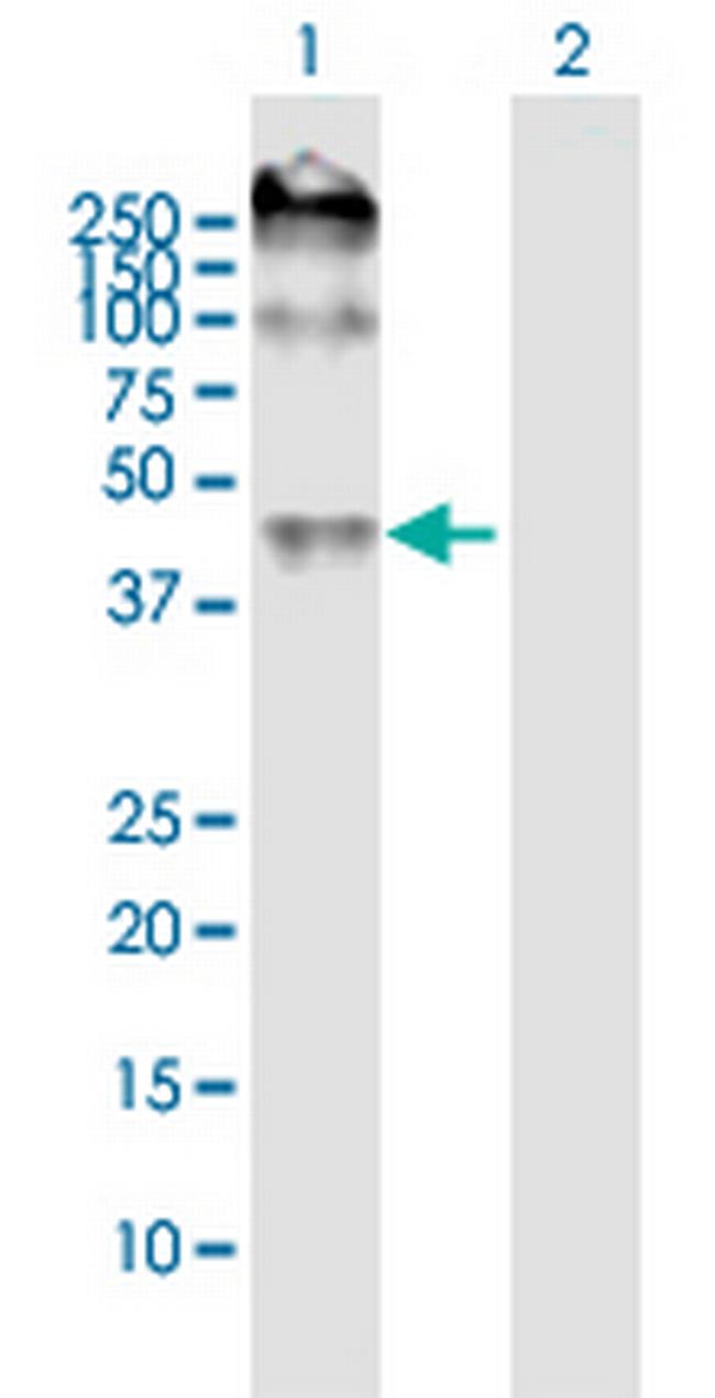 SLC29A2 Antibody in Western Blot (WB)