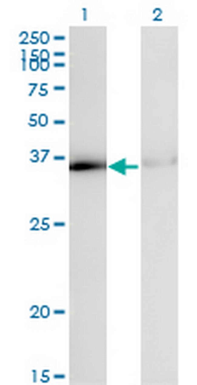 HNRPA1 Antibody in Western Blot (WB)