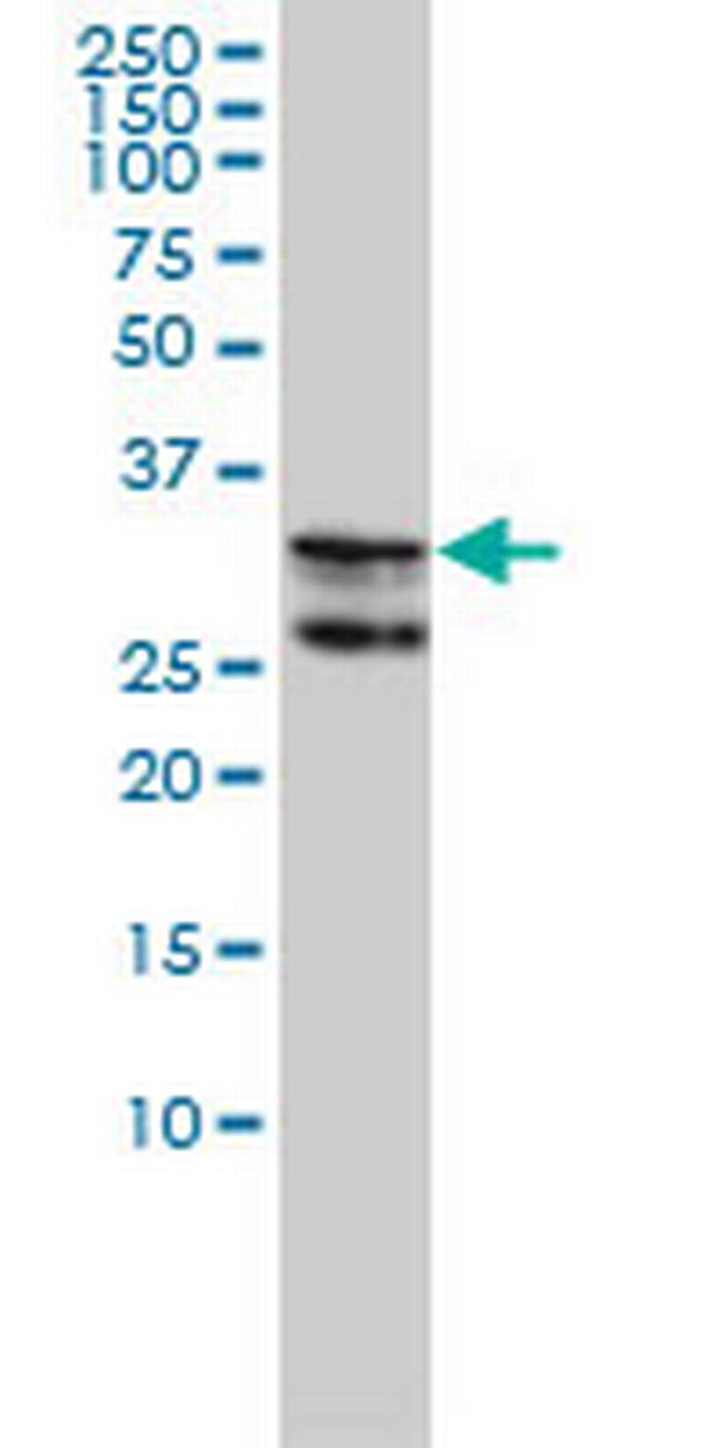 HNRPA2B1 Antibody in Western Blot (WB)