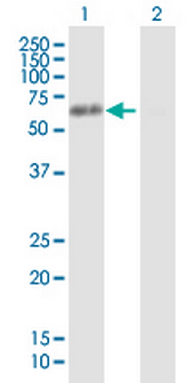 HNRNPK Antibody in Western Blot (WB)