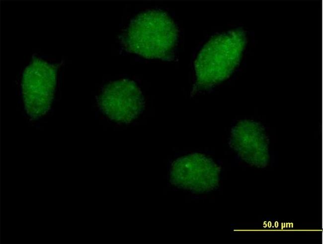 HOXA1 Antibody in Immunocytochemistry (ICC/IF)