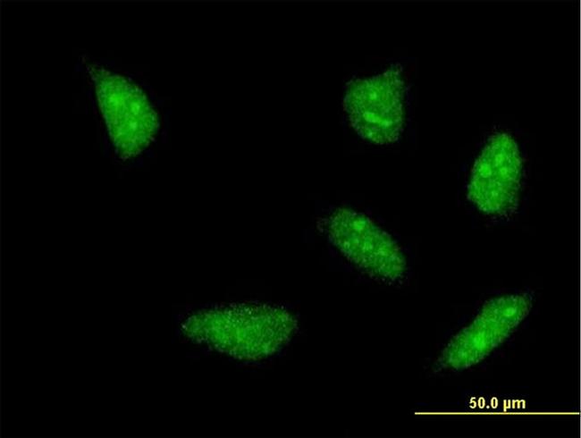 HOXA5 Antibody in Immunocytochemistry (ICC/IF)