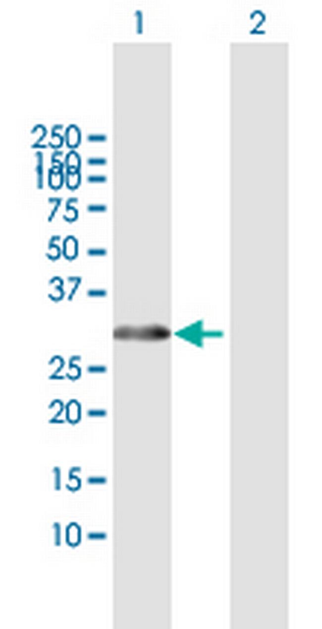 HOXB1 Antibody in Western Blot (WB)