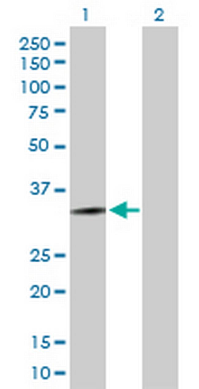 HOXD13 Antibody in Western Blot (WB)