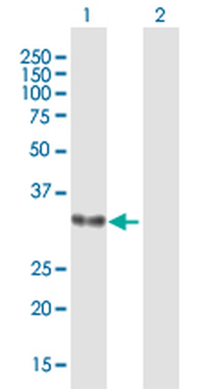 HP Antibody in Western Blot (WB)