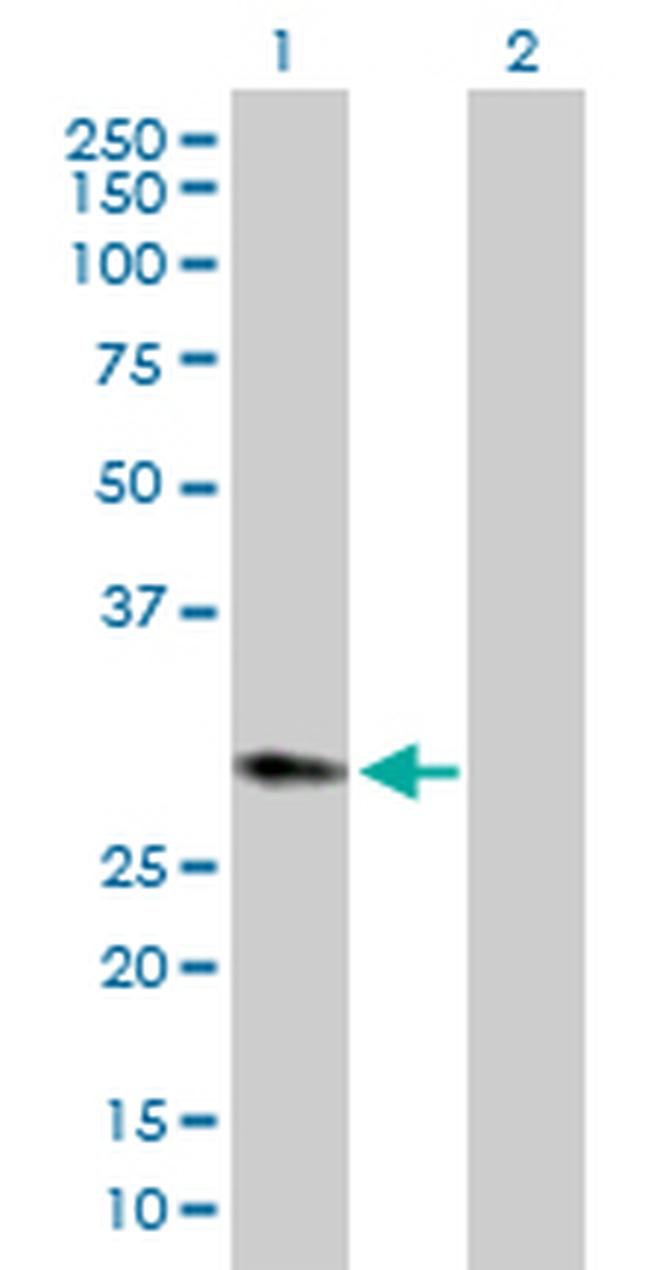 HPGD Antibody in Western Blot (WB)