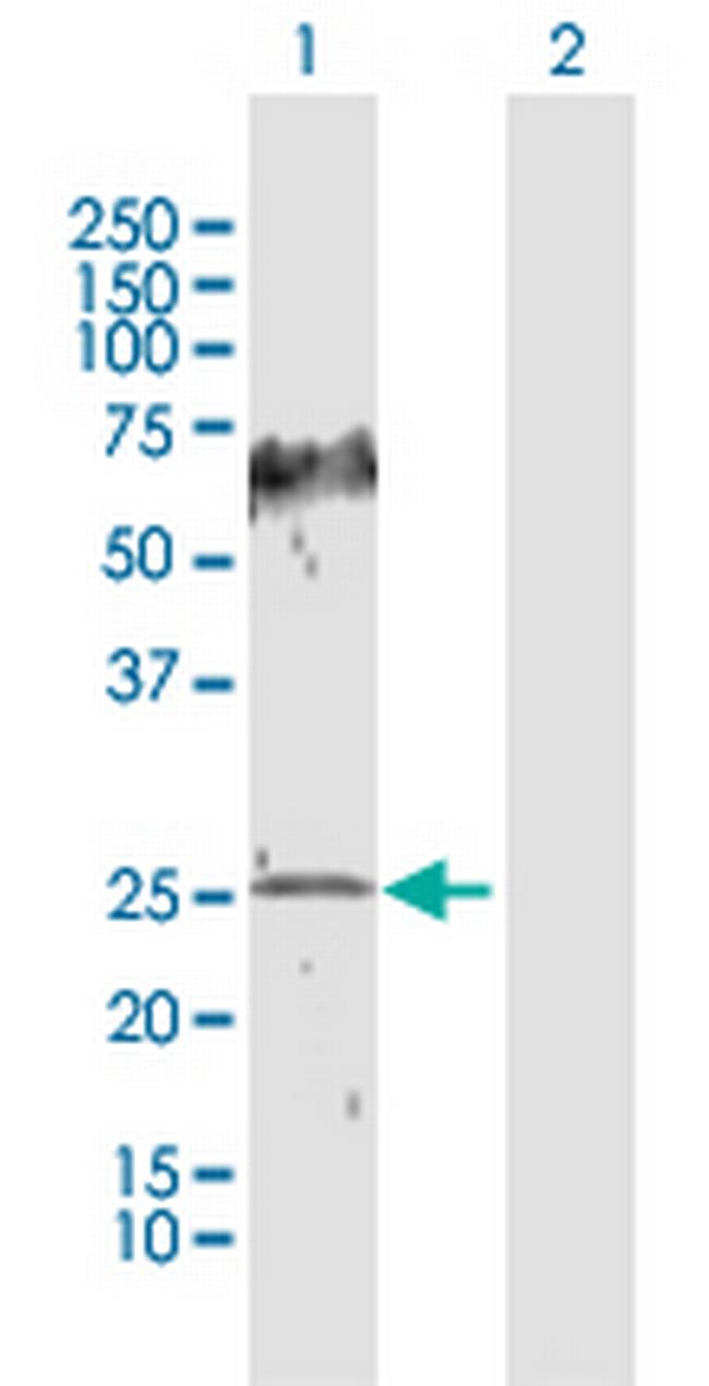 HPGD Antibody in Western Blot (WB)