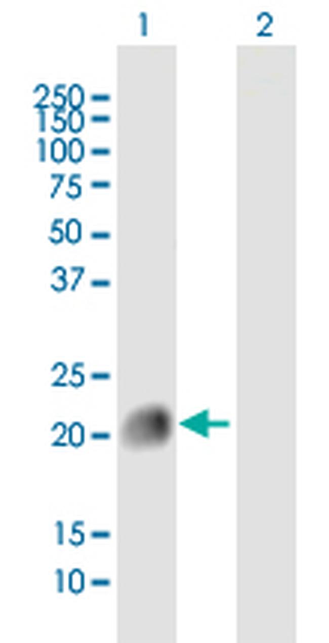 HRAS Antibody in Western Blot (WB)