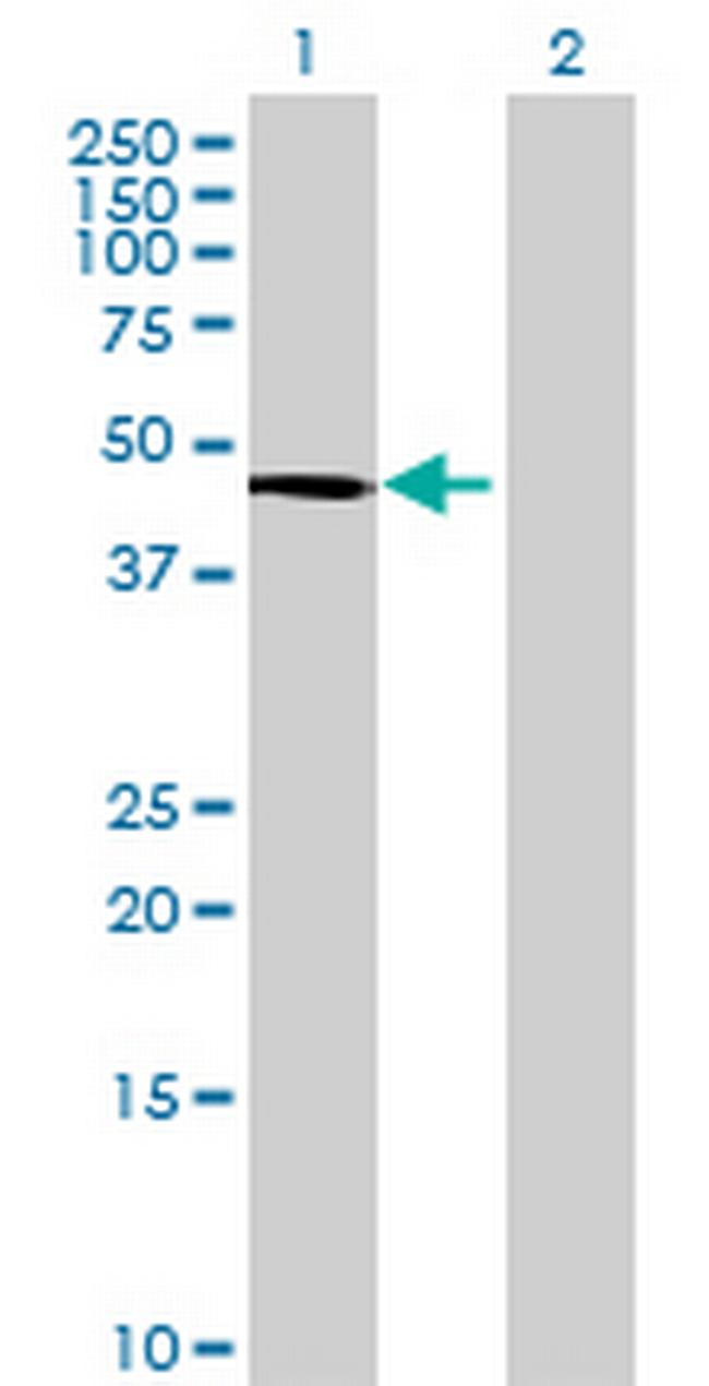 HRMT1L1 Antibody in Western Blot (WB)