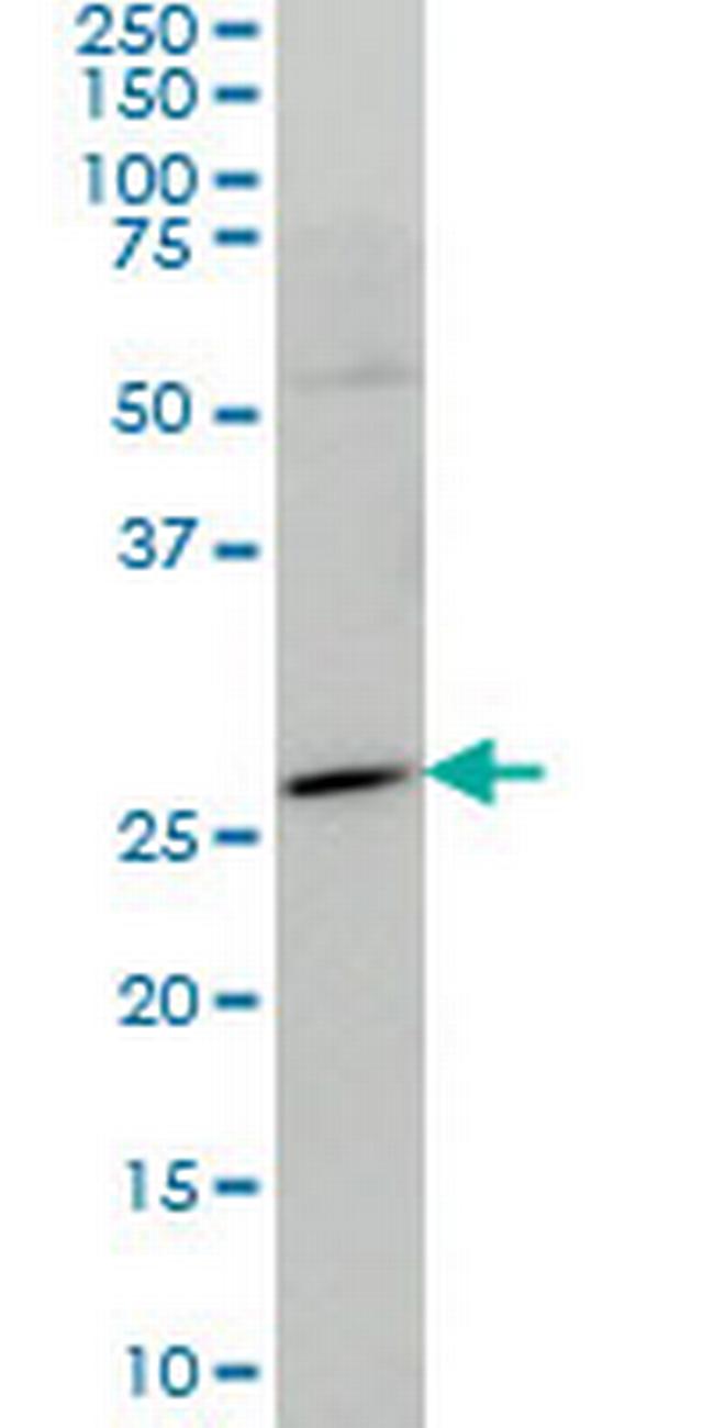 HES1 Antibody in Western Blot (WB)