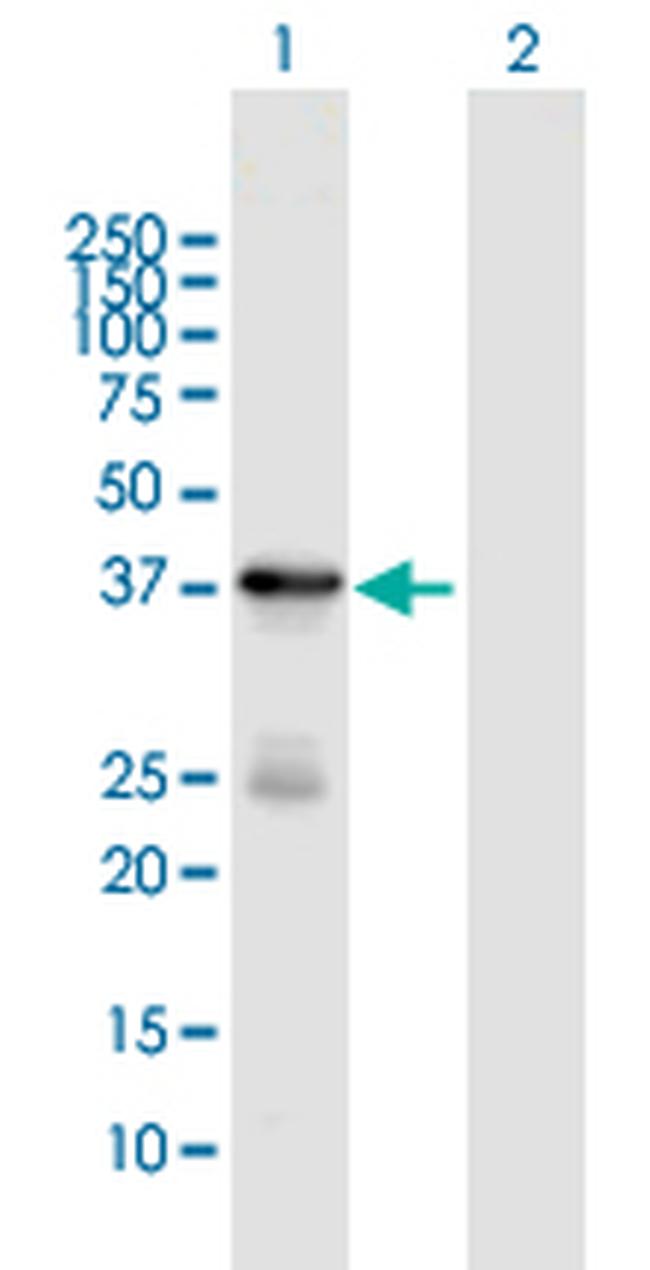 HSD3B1 Antibody in Western Blot (WB)