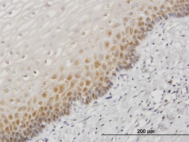 HSPA1B Antibody in Immunohistochemistry (Paraffin) (IHC (P))